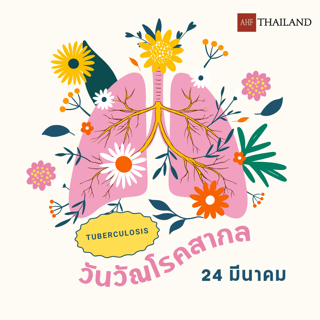 24 มีนา 