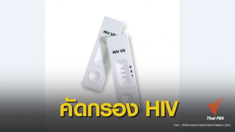 อย.ปลดล็อก “ชุดตรวจ HIV” ซื้อจากร้านขายยาตรวจเองได้